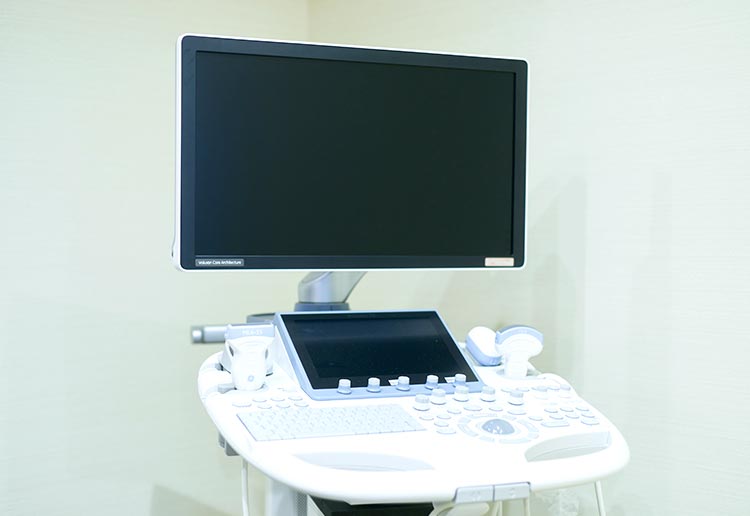 4D超音波検査装置（4Dエコー）