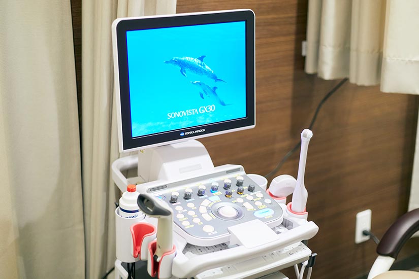 超音波検査装置（エコー）